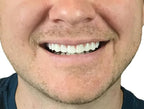 Instant Smile Comfort Fit Flex Teeth - Natural Look

