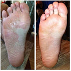 Toenail Fungus Treatment Extra Strength Foot Deodorizer

