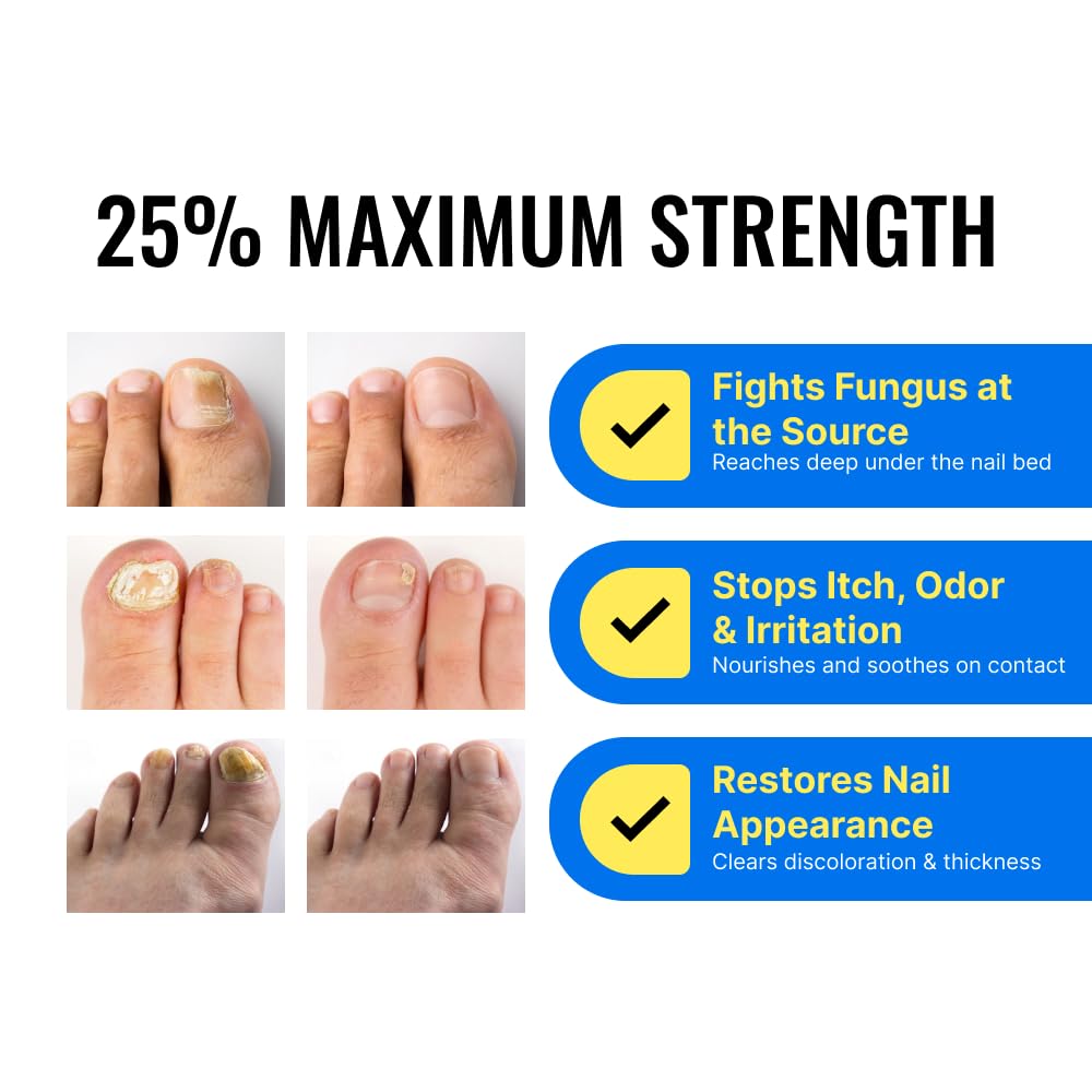 Nail Serum by Approved Science Fungix - Undecylenic Acid

