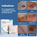 Dimora Silicone Wound Dressings with Gentle Adhesive

