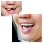 Instant Smile Comfort Fit Flex Teeth - Natural Look

