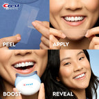Crest 3D Teeth Whitening Kit | Enamel-Safe Whitening

