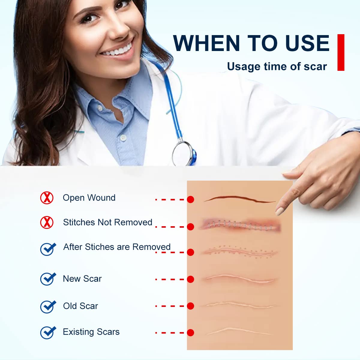 Medical Grade Silicone Therapy for Skin Healing


