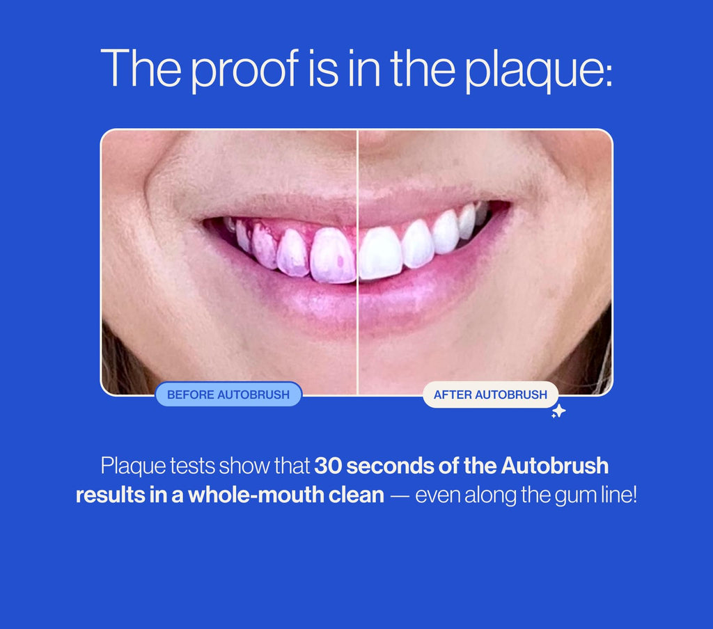 Autobrush Sonic Pro Toothbrush ADA-accepted U-Shaped

