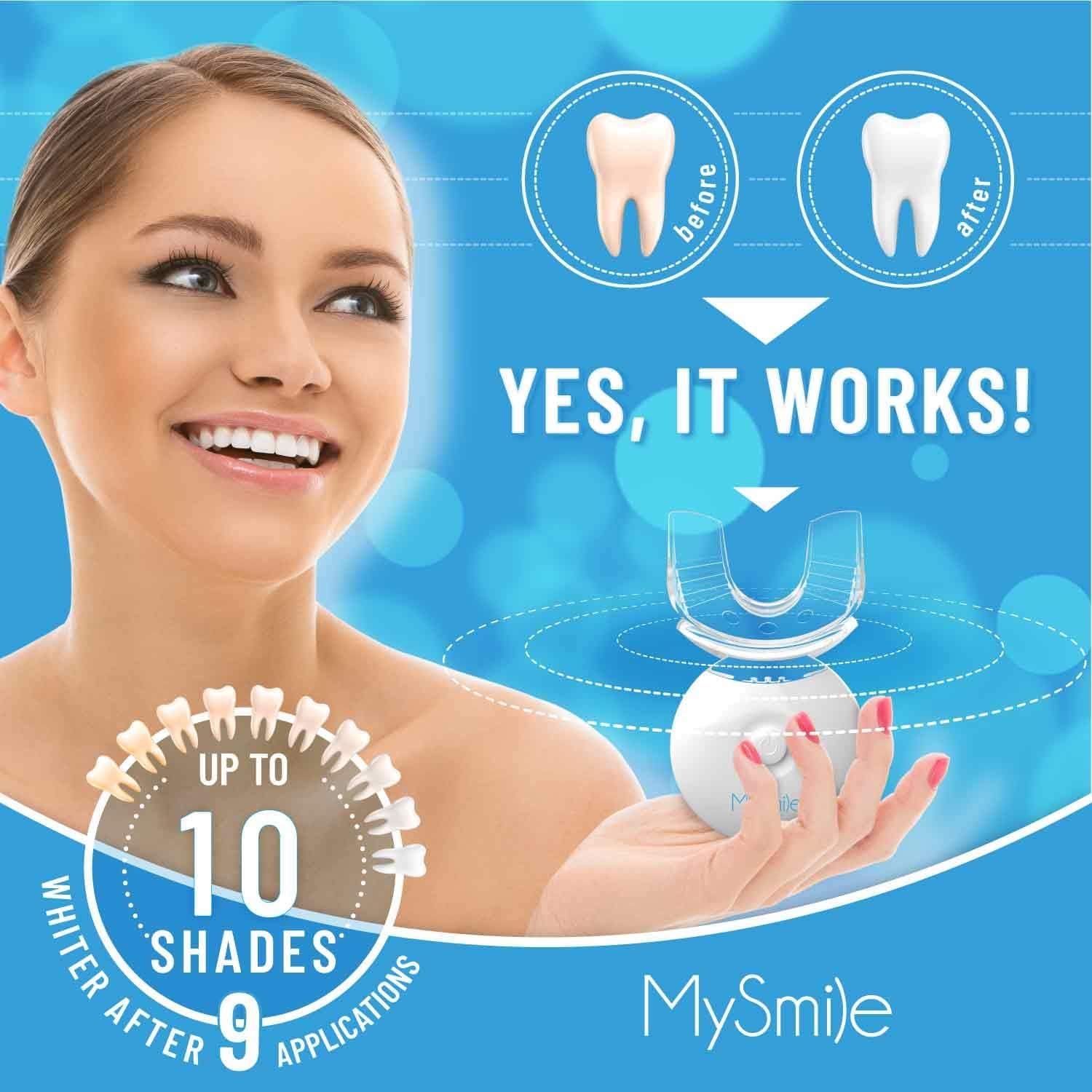MySmile LED Teeth Whitening Kit - At-Home Whitening

