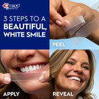Crest 3D White Whitestrips Age Renew Teeth Whitening Kit

