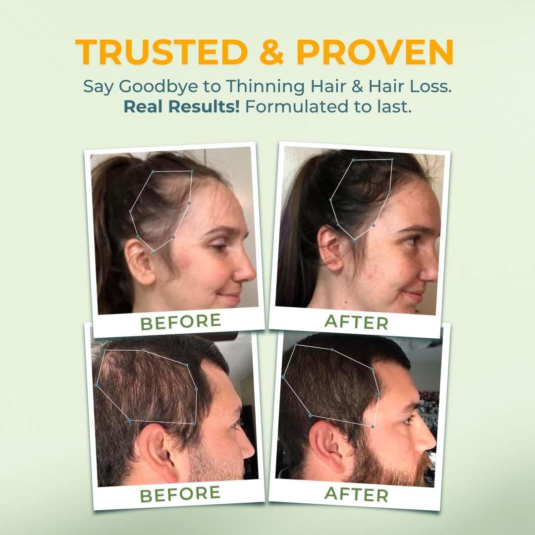 Vital Nutritive Vital Hair Complex - Hair Growth Vitamins

