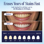 BocaBella Teeth Whitening Trays U-Wraps Enamel-Safe Formula

