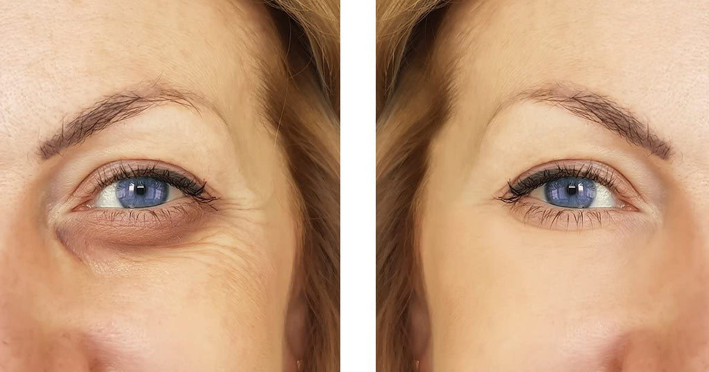 Verisol Collagen Bioactive Peptides – Collagen Powder

