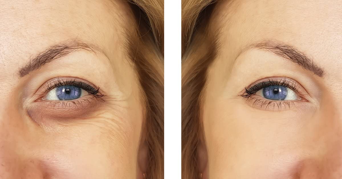 Verisol Collagen Bioactive Peptides – Collagen Powder

