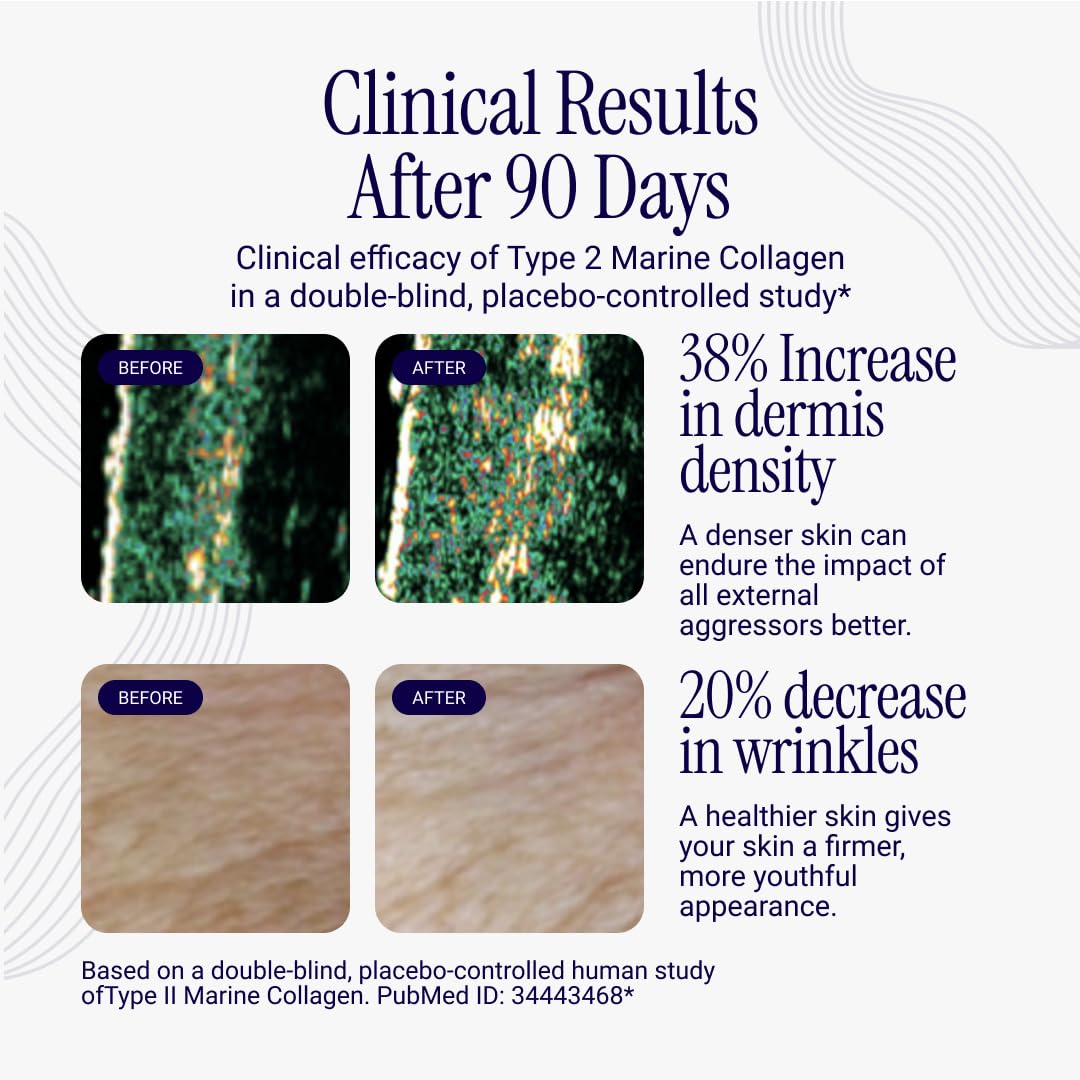 Rho Nutrition Liposomal Collagen Peptides | Skin & Joint

