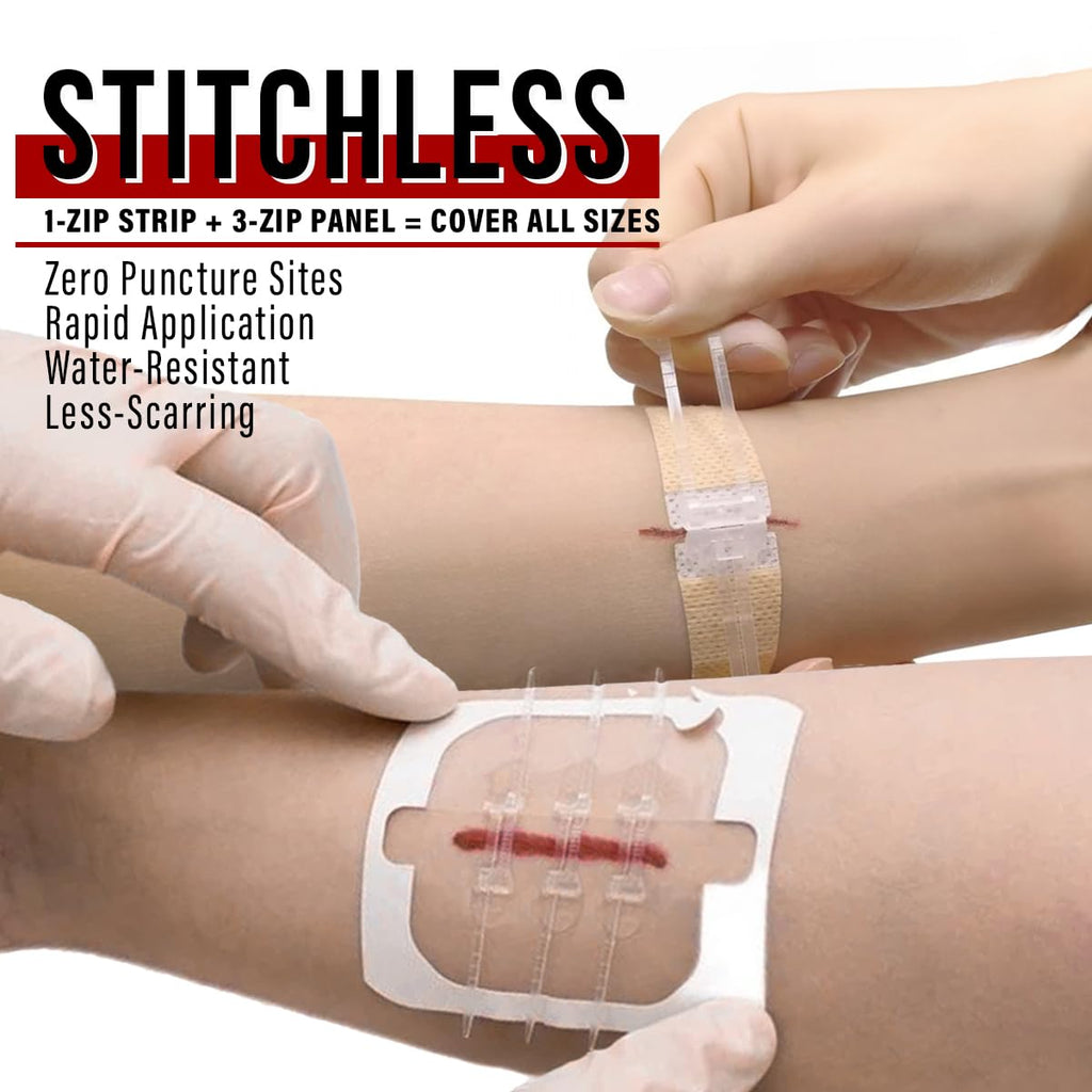 EVERLIT Wound Closure System | Suture-Free Zip-Stitch


