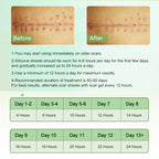 Medical Grade Silicone Therapy for Skin Healing

