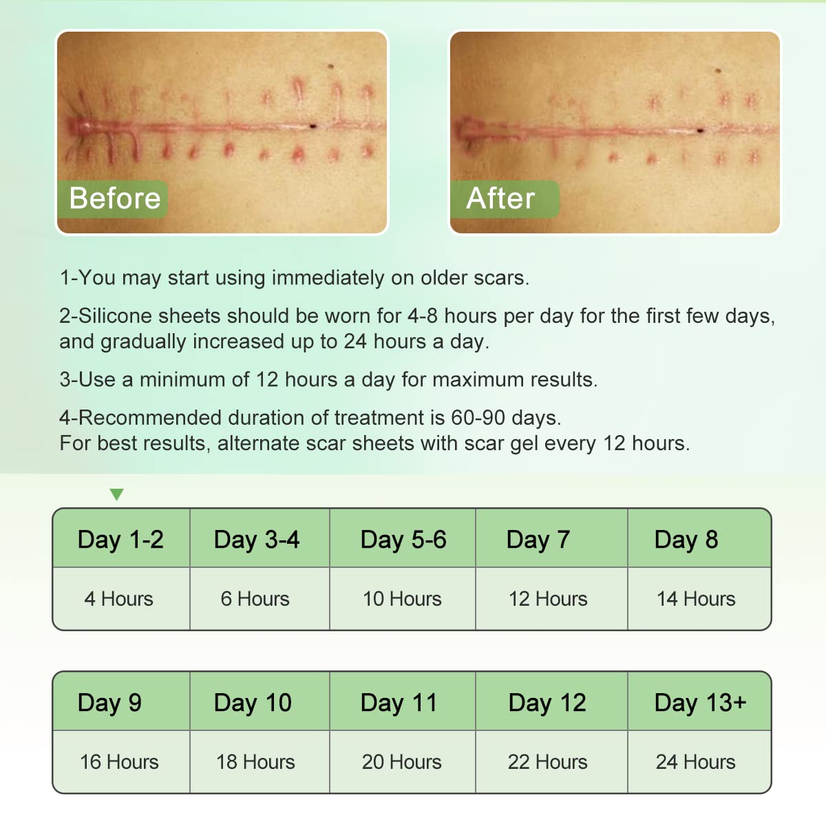 Medical Grade Silicone Therapy for Skin Healing

