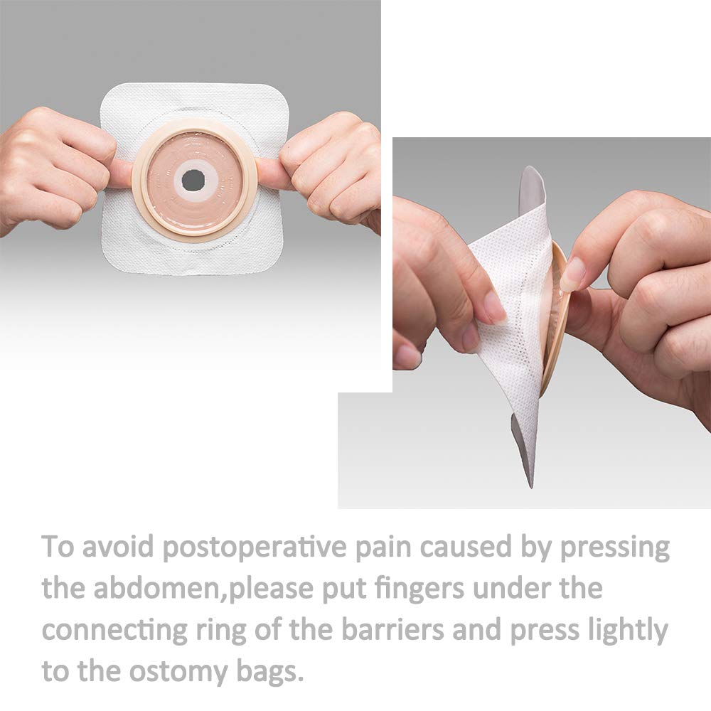 Carbou Ostomy Pouches & Barrier System | Drainable Care


