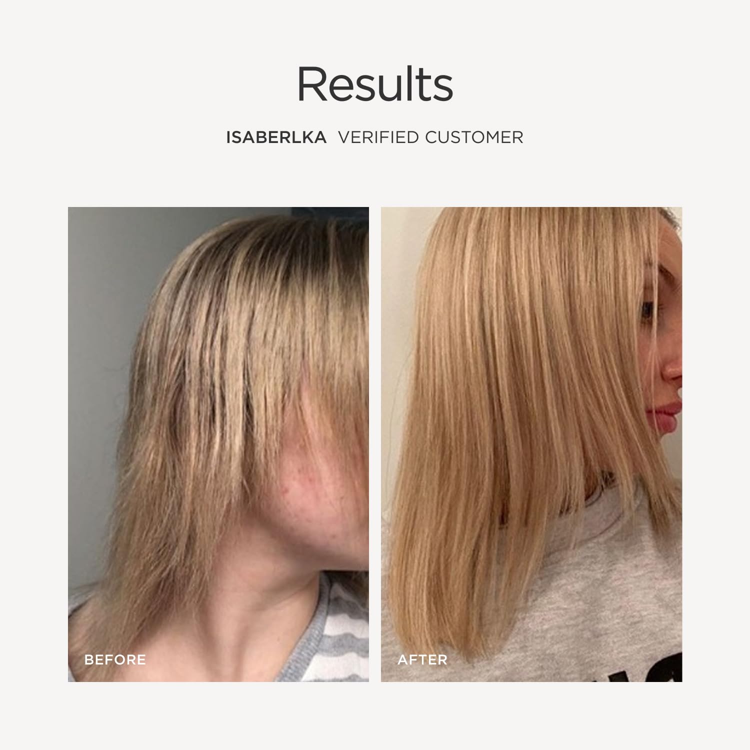 JSHealth Hair Growth Vitamins for Women – Hair Strength

