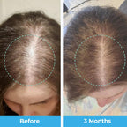 Postpartum Hair Growth Gummies by Baby Blues

