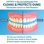 Gum Restore - UNITEIN Dental Care

