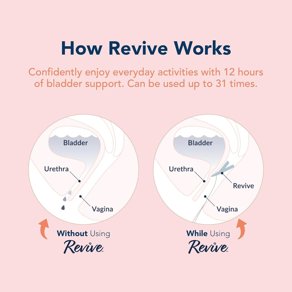 Revive Bladder Support Pessary for Women | SUI Device

