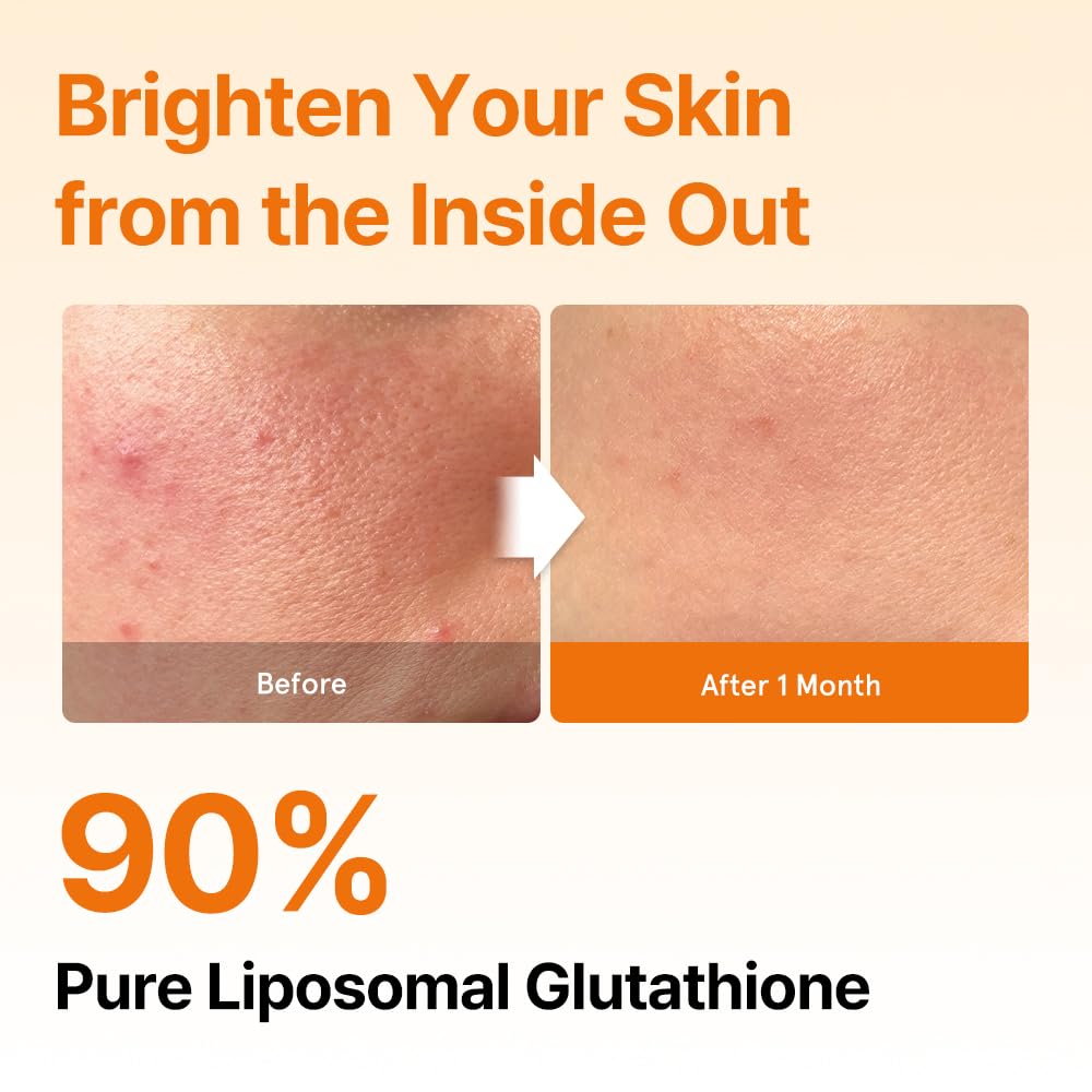 Liposomal Glutathione Strips by Glutathione Direct

