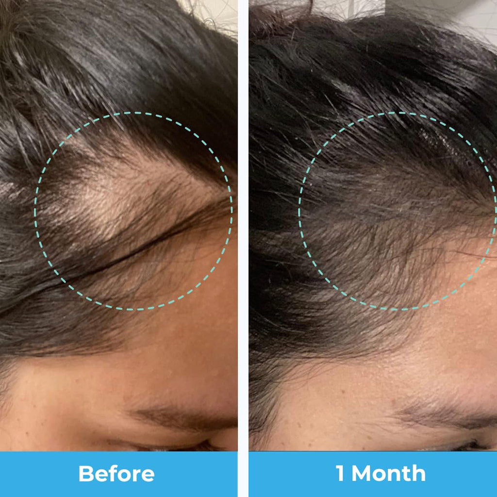 Postpartum Hair Growth Gummies by Baby Blues

