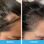Postpartum Hair Growth Gummies by Baby Blues

