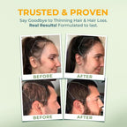 Hair Vitamins by Vital Nutritive – Vital Hair Complex

