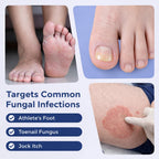 Toenail Fungus Treatment Pen - Extra Strength, FSA/HSA Eligible

