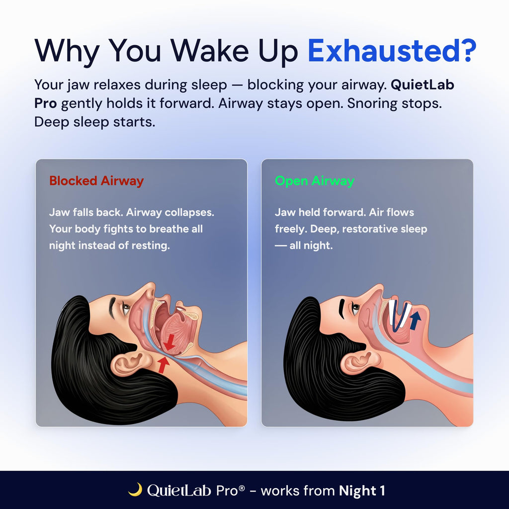QuietLab Pro Anti-Snoring Mouthpiece - BPA-Free

