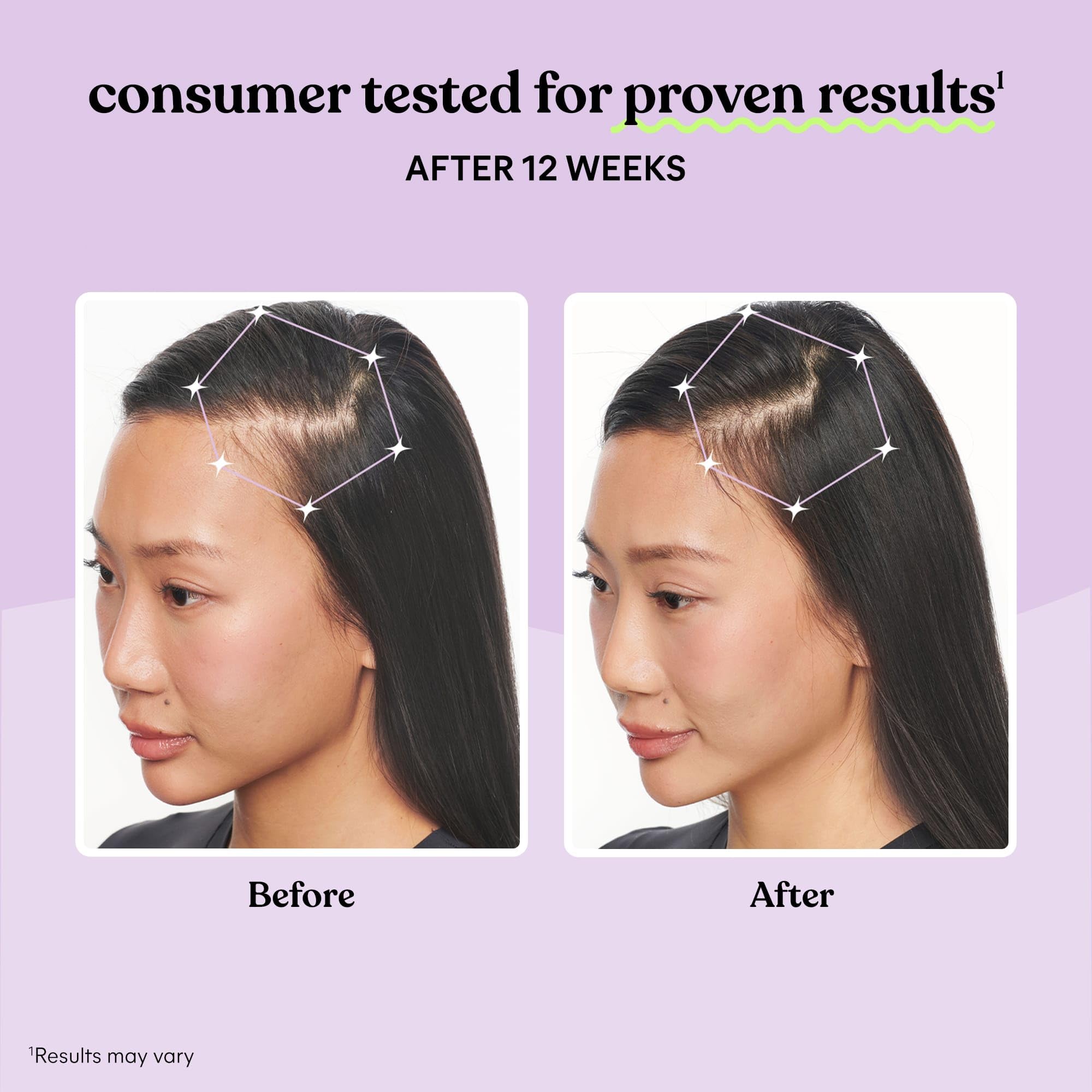 Hair Growth Capsules by Lemme Grow | Keratin Complex

