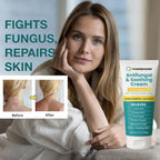 Antifungal Cream for Itchy Skin | Fast Relief

