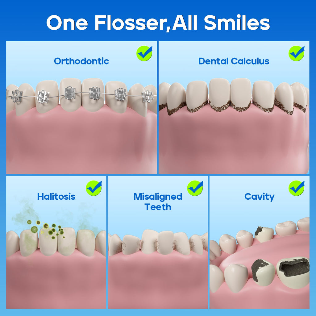 Nicwell Water Dental Flosser - 4 Modes, 11 Pressure Settings

