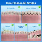 Nicwell Water Dental Flosser - 4 Modes, 11 Pressure Settings

