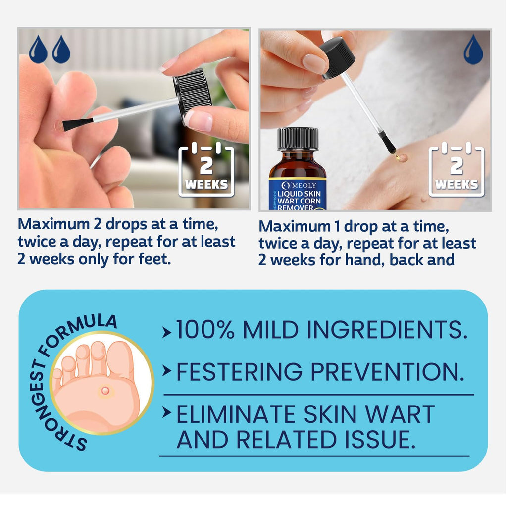 MEOLY Wart Remover - Fast-Acting Maximum Strength

