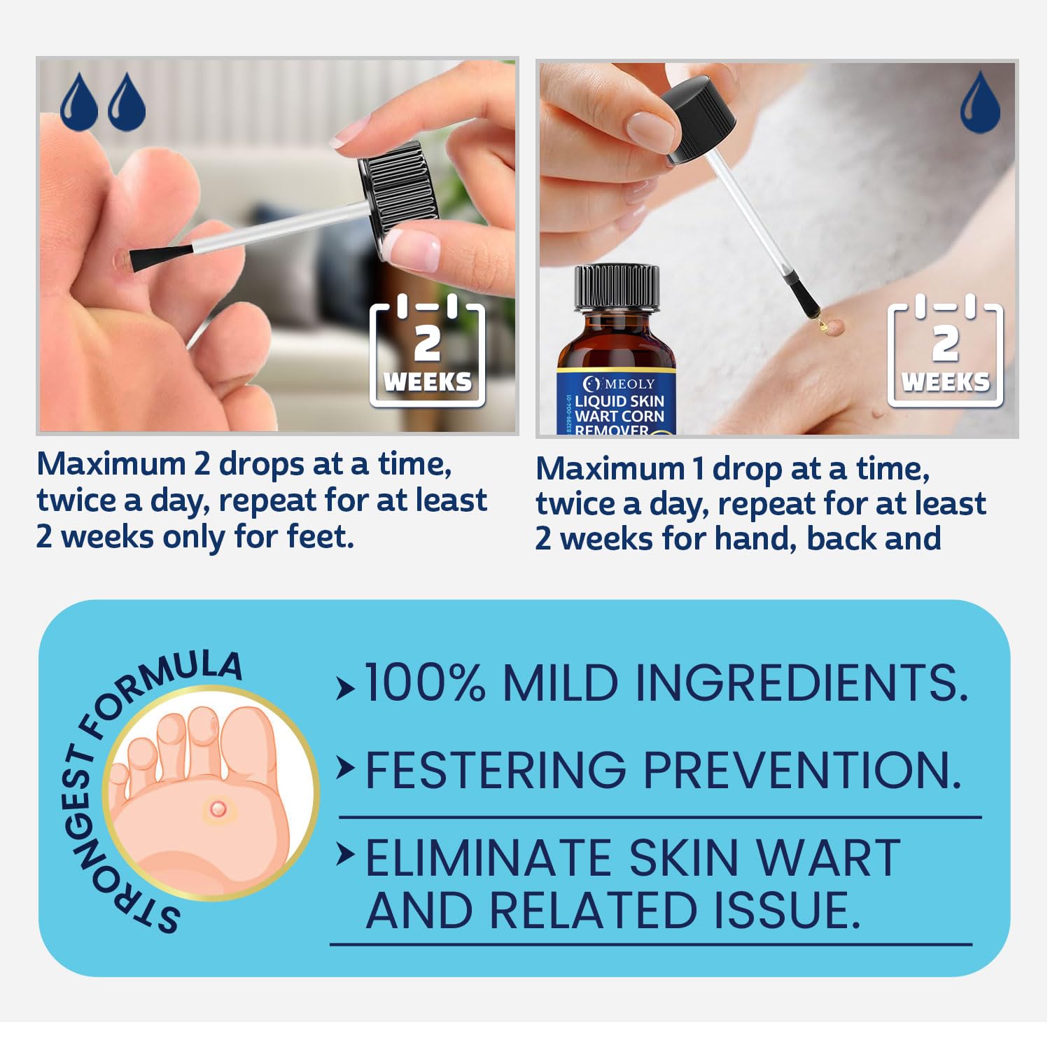 MEOLY Wart Remover - Fast-Acting Maximum Strength

