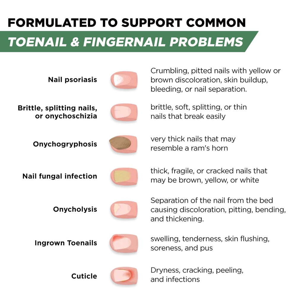FOOT CURE Toenail Renewal Solution Made in USA

