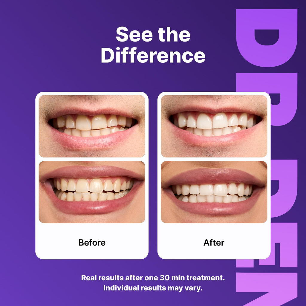 DRDENT Purple Teeth Whitening System | Safe for Enamel


