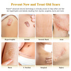Silicone Scar Gel for Surgical Scars | Gentle & Effective

