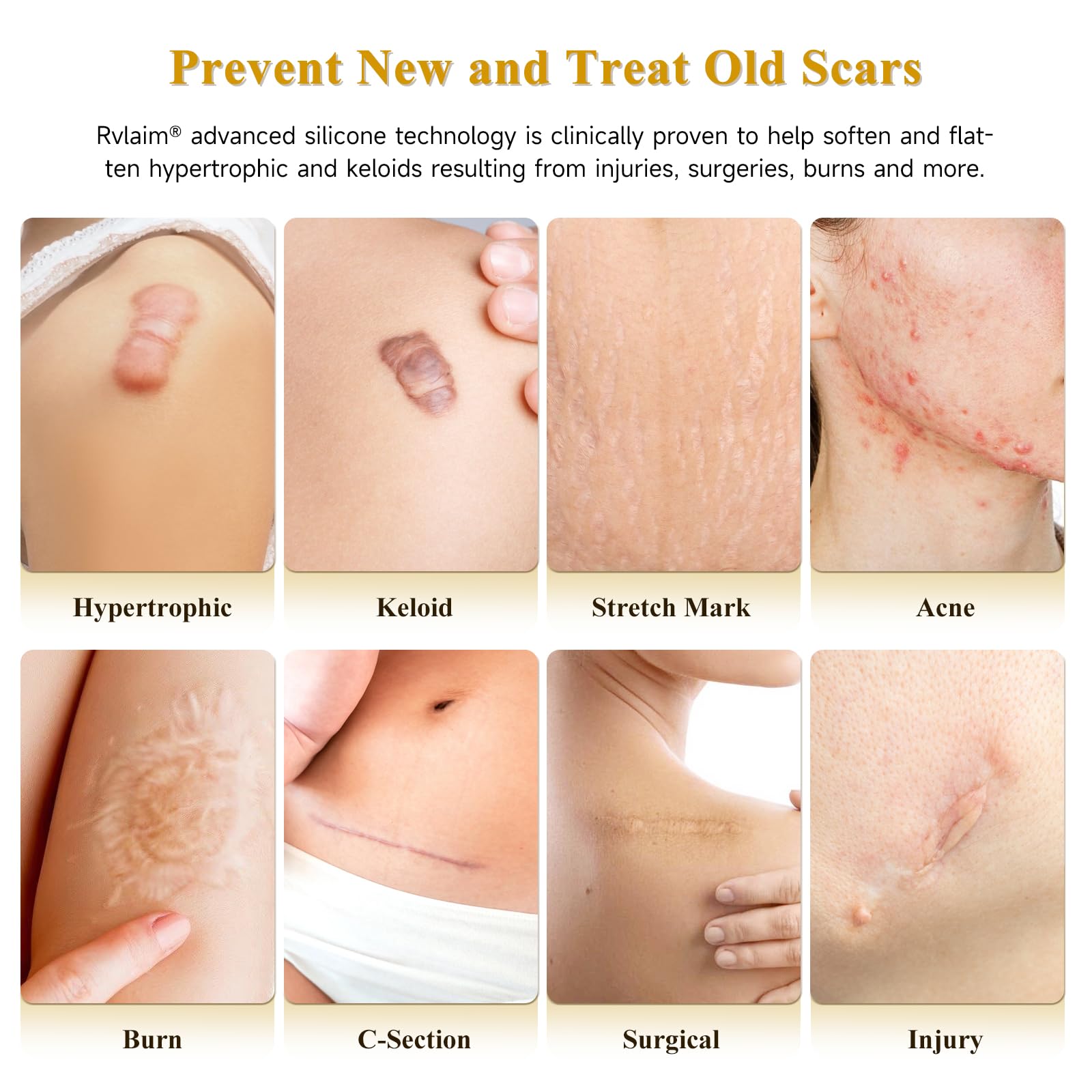 Silicone Scar Gel for Surgical Scars | Gentle & Effective

