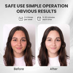LED Facial Mask for Skin Care | Light Therapy

