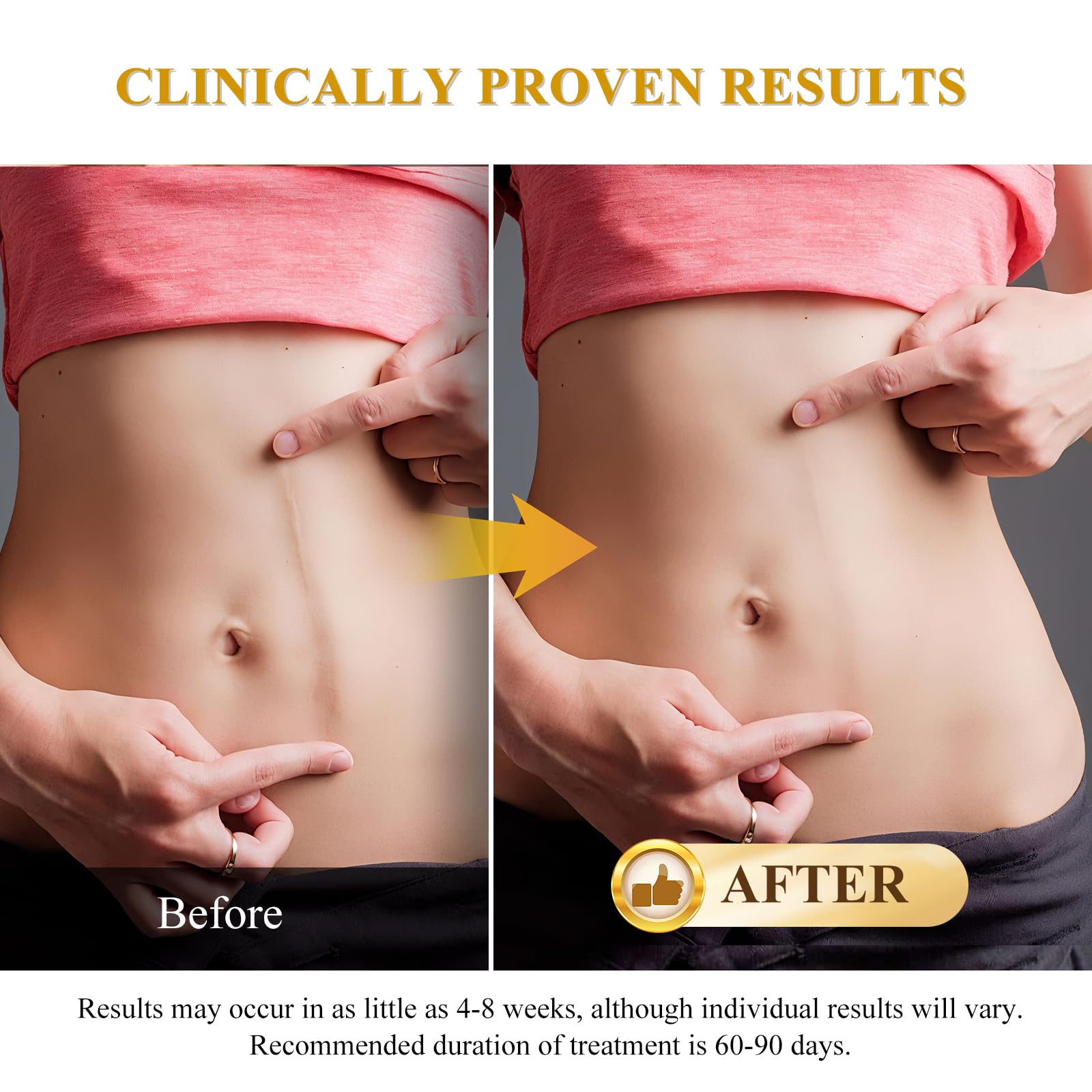 Silicone Scar Gel for Surgical Scars | Gentle & Effective

