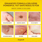 SupreH Bee Venom Wart Remover with Salicylic Acid

