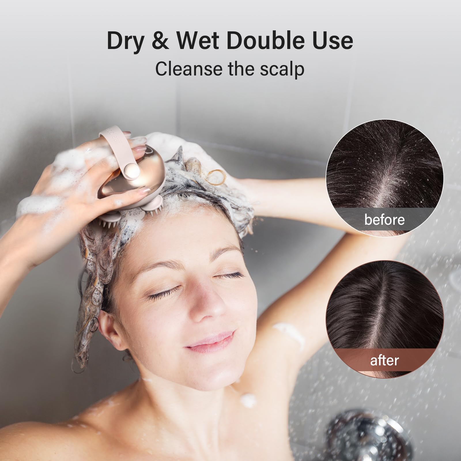 arboleaf Scalp Massager Kneading Head Massager USB


