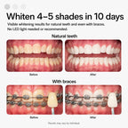 Opalescence Go Teeth Whitening Kit | Prefilled Trays

