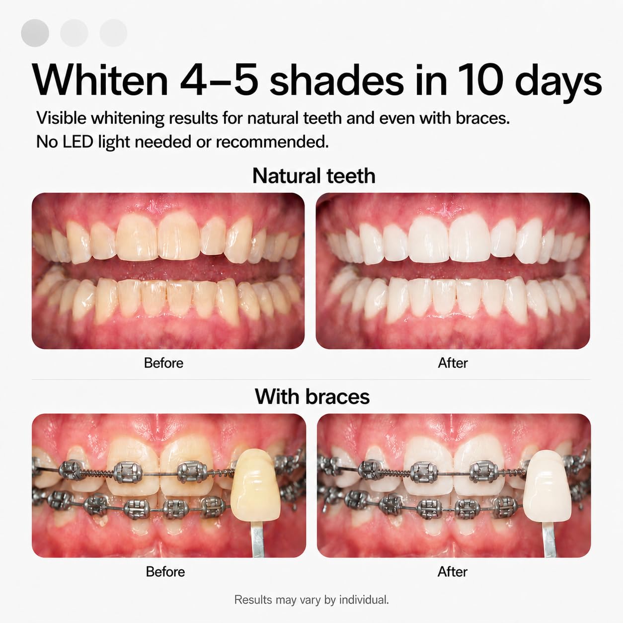 Opalescence Go Whitening Bundle with Prefilled Trays

