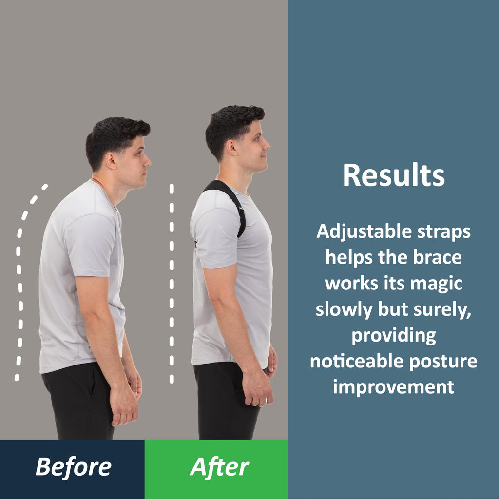 ComfyBrace Posture Corrector for Men and Women | Adjustable

