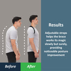 ComfyBrace Posture Corrector for Men and Women | Adjustable

