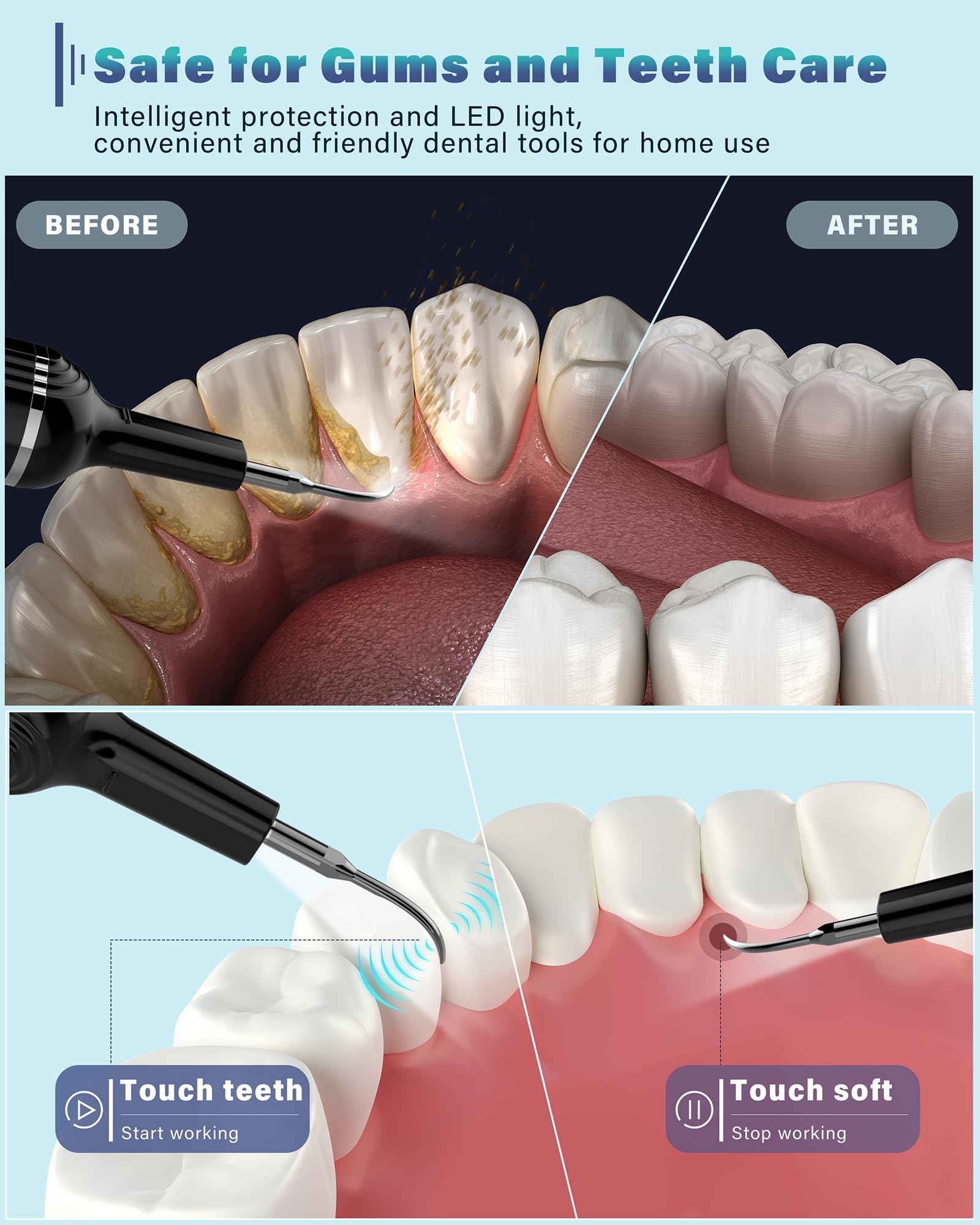 Tartar Remover for Teeth with LED Light - Dental Cleaner

