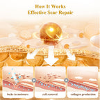 Silicone Scar Gel for Surgical Scars | Gentle & Effective

