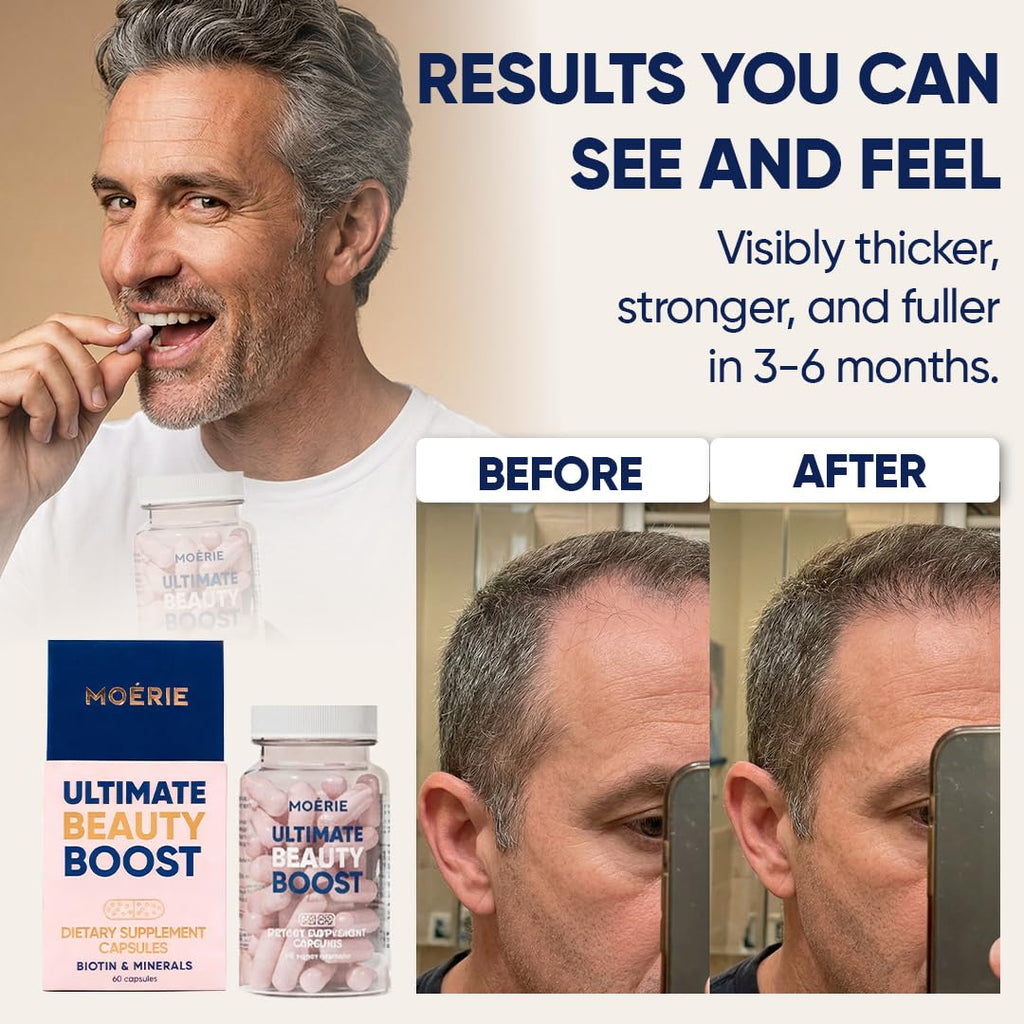 Moerie Hair Boost Supplements for Hair Skin Nails

